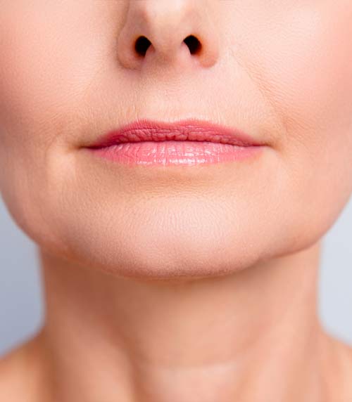 An older woman with lip filler