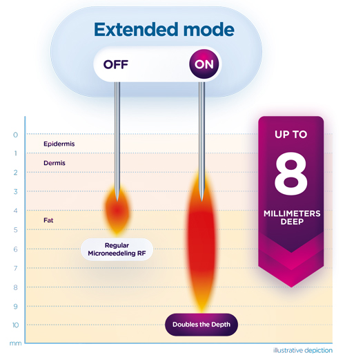 Exion fraction diagram