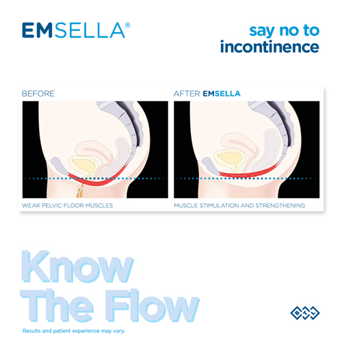 Emsella Diagram