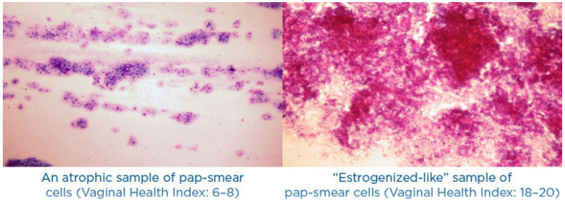 Before and after Exion skin treatment